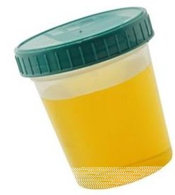 正常尿液