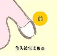 包皮