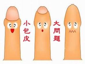 包茎问题