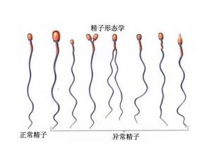 弱精症