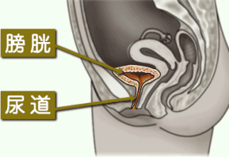 膀胱炎