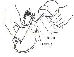 阳痿