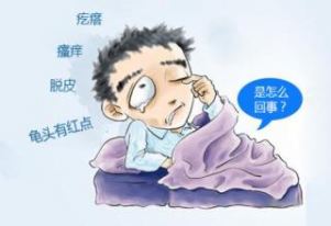 龟头炎问题