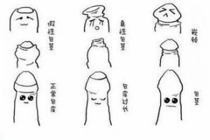 包皮问题