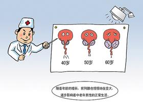 前列腺增生