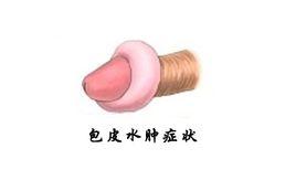 龟头炎