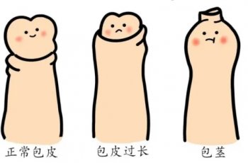 上海哪个医院可以做包皮手术?